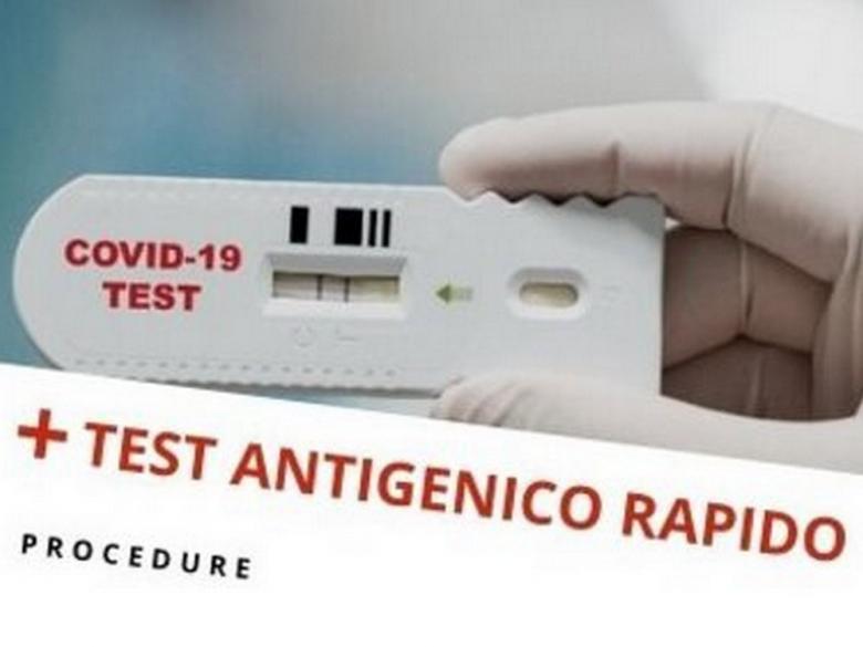 Test antigenico rapido